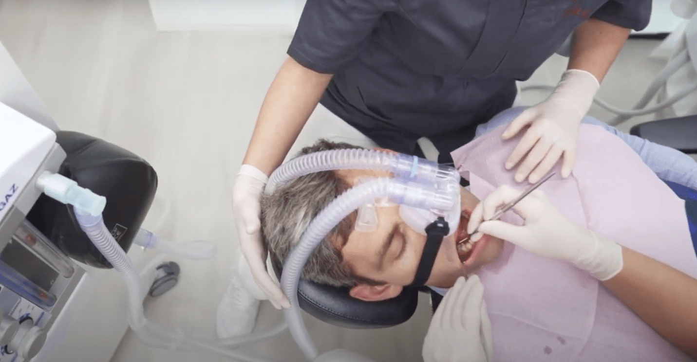 Guida alla sedazione cosciente dal dentista con protossido d'azoto