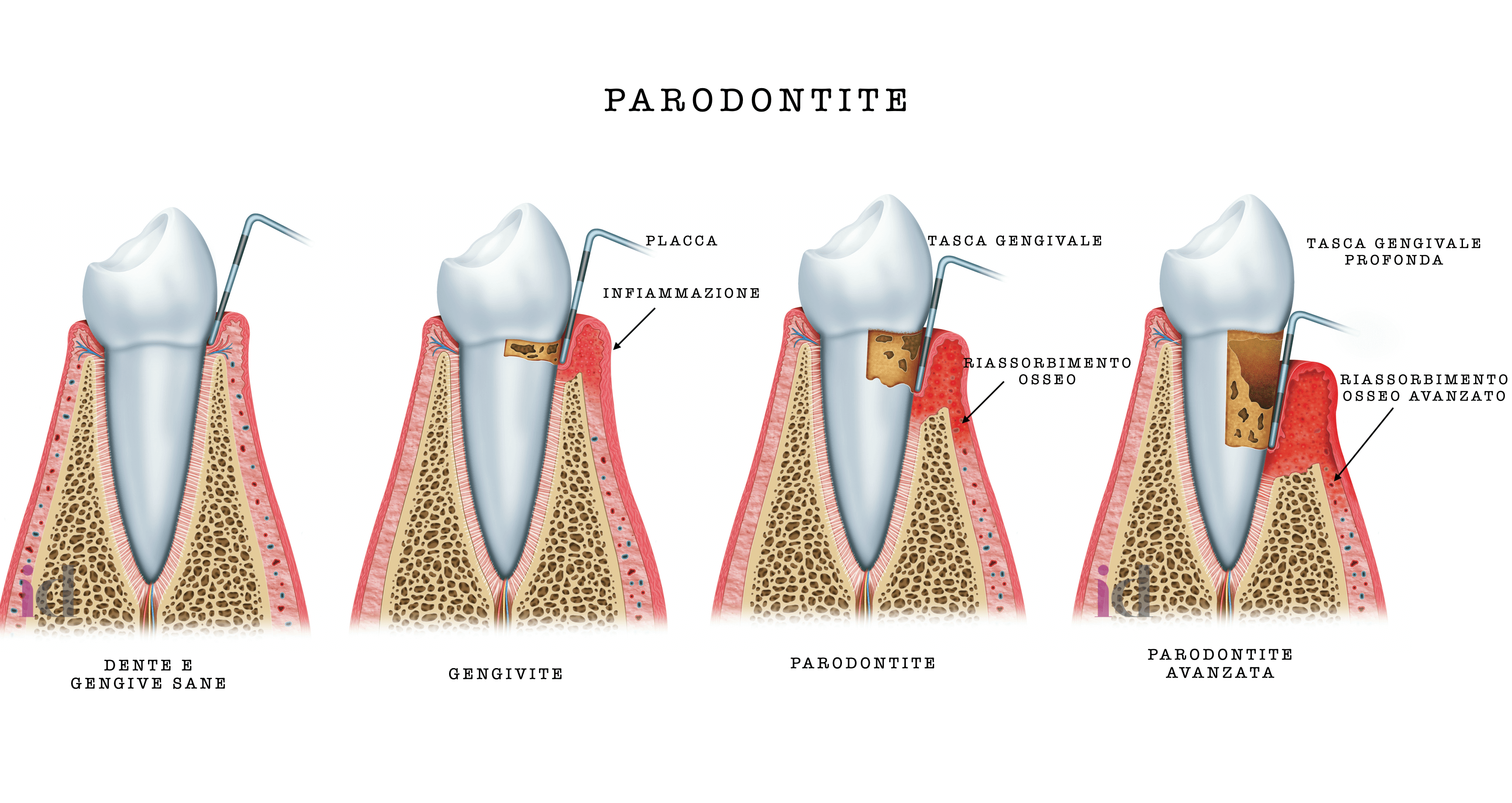 chirurgia parodontale blocco 1